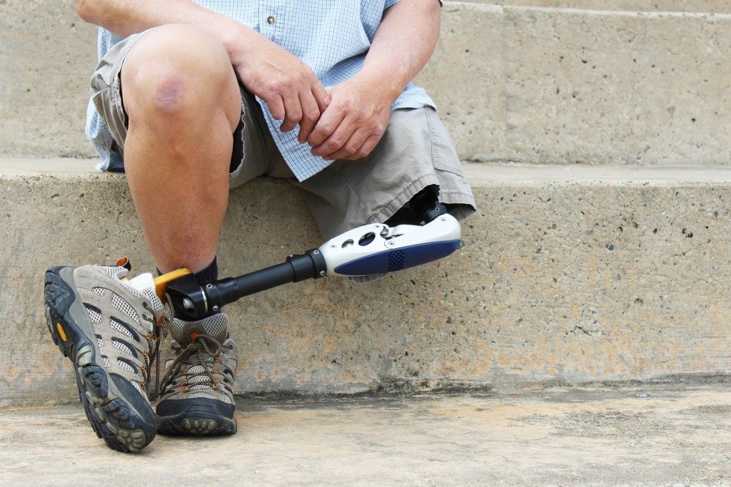 man with leg prosthetic
